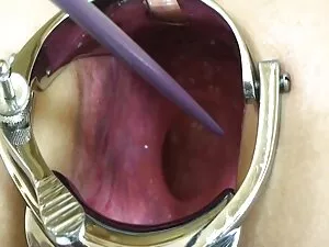 18videoz-Lota - boke ...
